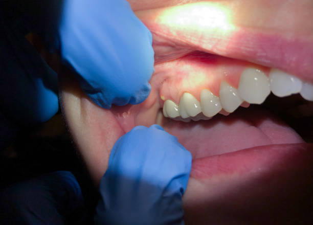 Best Weekend Emergency Dentist in Fredonia, WI